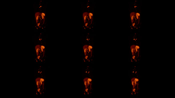 astonish reconstruction thumbnail