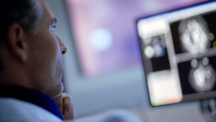 Understanding how Compressed SENSE makes MRI faster