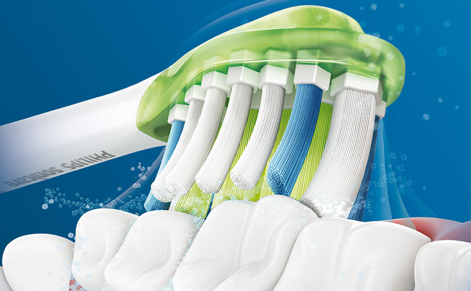 Diskusija: parastā jeb manuālā pret elektrisko zobu birsti