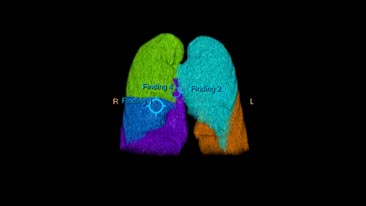 multi modality tumor tracking qeasl